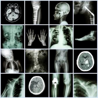 2xray